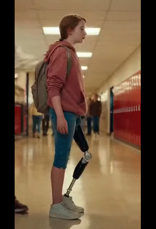 They Mocked Me for My Prosthetic Leg — But Then the Black SUVs Showed Up.