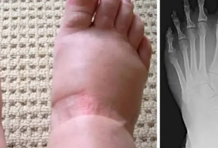 there-are-nine-scary-warning-symptoms-of-swollen-feet-that-you-should-never-overlook